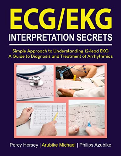 ECG/EKG INTERPRETATION SECRETS: Simple Approach to Understanding 12-Lead EKG. A Guide to Diagnosis and Treatment of Arrhythmias