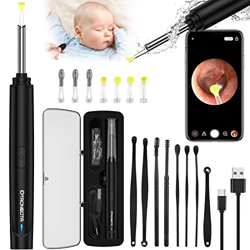 OTAONEOTA Ear Wax Removal Tool, Ear Cleaner with 1296P FHD Camera, Ear Cleaning Kit with Lights and Built-in WiFi, Compatible with iPhone, iPad, and Android